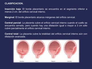 CLASIFICACION.
Inserción baja: El borde placentario se encuentra en el segmento inferior a
menos 2 cm. del orificio cervical interno.
Marginal: El borde placentario alcanza márgenes del orificio cervical.
Central parcial: La placenta cubre el orificio cervical interno cuando el cuello se
encuentra cerrado, pero cuando hay una dilatación igual o mayor a 3 cm sólo
cubre parcialmente el orificio cervical interno.
Central total: La placenta cubre la totalidad del orificio cervical interno aún con
dilatación avanzada.
 