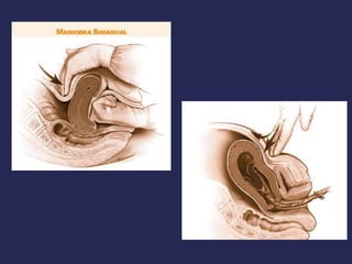 Hemorragia obstetrica