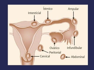 Hemorragia obstetrica