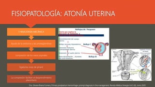 FISIOPATOLOGÍA: ATONÍA UTERINA
Dra. Silvana Rivera Fumero, Primary postpartum hemorrhage: prompt diagnosis in the manageme...
