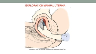 EXPLORACION MANUAL UTERINA
 
