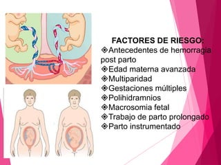 FACTORES DE RIESGO:
Desprendimiento prematuro de
placenta normoinserta
Placenta previa
Placenta acreta
Tratamiento ant...