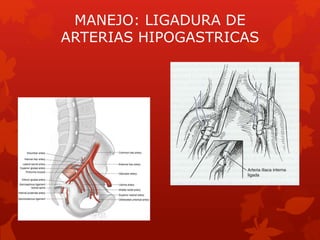 Hemorragia obstetrica 2014