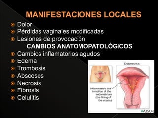 Hemorragia obstetrica aborto