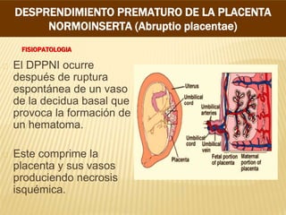 FISIOPATOLOGIA
El DPPNI ocurre
después de ruptura
espontánea de un vaso
de la decidua basal que
provoca la formación de
un hematoma.
Este comprime la
placenta y sus vasos
produciendo necrosis
isquémica.
DESPRENDIMIENTO PREMATURO DE LA PLACENTA
NORMOINSERTA (Abruptio placentae)
 