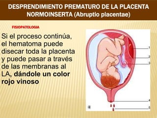 FISIOPATOLOGIA
Si el proceso continúa,
el hematoma puede
disecar toda la placenta
y puede pasar a través
de las membranas al
LA, dándole un color
rojo vinoso
DESPRENDIMIENTO PREMATURO DE LA PLACENTA
NORMOINSERTA (Abruptio placentae)
 