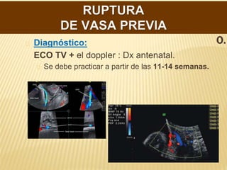 DIAGNÓSTIC
O.
Diagnóstico:
ECO TV + el doppler : Dx antenatal.
Se debe practicar a partir de las 11-14 semanas.
 