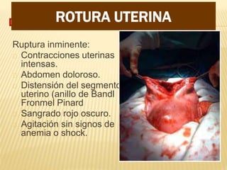 DIAGNOSTICO
Ruptura inminente:
Contracciones uterinas
intensas.
Abdomen doloroso.
Distensión del segmento
uterino (anillo de Bandl
Fronmel Pinard
Sangrado rojo oscuro.
Agitación sin signos de
anemia o shock.
ROTURA UTERINA
 