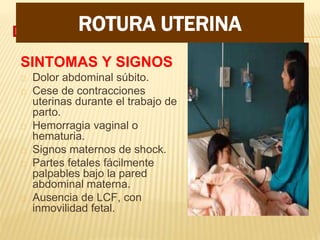 DIAGNOSTICO
SINTOMAS Y SIGNOS
Dolor abdominal súbito.
Cese de contracciones
uterinas durante el trabajo de
parto.
Hemorragia vaginal o
hematuria.
Signos maternos de shock.
Partes fetales fácilmente
palpables bajo la pared
abdominal materna.
Ausencia de LCF, con
inmovilidad fetal.
ROTURA UTERINA
 