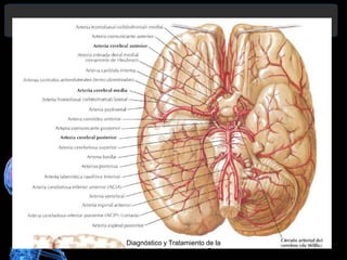 Diagnóstico y Tratamiento de la
hemorragia intracerebral. Dr.
 