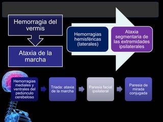 Ataxia de la
marcha
Hemorragia del
vermis
Hemorragias
hemisféricas
(laterales)
Ataxia
segmentaria de
las extremidades
ipsilaterales
Hemorragias
mediales y
ventrales del
pedúnculo
cerebeloso
Triada: ataxia
de la marcha
Paresia facial
ipsilateral
Paresia de
mirada
conjugada
Diagnóstico y Tratamiento de la
hemorragia intracerebral. Dr.
 