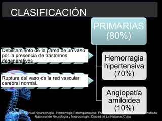 CLASIFICACIÓN
PRIMARIAS
(80%)
Hemorragia
hipertensiva
(70%)
Angiopatía
amiloidea
(10%)
Debilitamiento de la pared de un vaso
por la presencia de trastornos
degenerativos
Ruptura del vaso de la red vascular
cerebral normal.
II Congreso Virtual Neurocirugía . Hemorragia Parenquimatosa. Francisco Goyenechea Gutiérrez. Instituto
Nacional de Neurología y Neurocirugía. Ciudad de La Habana, Cuba
 