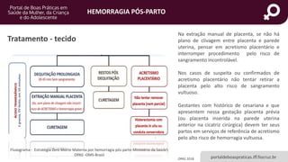 HEMORRAGIA PÓS-PARTO
portaldeboaspraticas.iff.fiocruz.br
Na extração manual de placenta, se não há
plano de clivagem entre placenta e parede
uterina, pensar em acretismo placentário e
interromper procedimento pelo risco de
sangramento incontrolável.
Nos casos de suspeita ou confirmados de
acretismo placentário não tentar retirar a
placenta pelo alto risco de sangramento
vultuoso.
Gestantes com histórico de cesariana e que
apresentem nessa gestação placenta prévia
(ou placenta inserida na parede uterina
anterior na cicatriz cirúrgica) devem ter seus
partos em serviços de referência de acretismo
pelo alto risco de hemorragia vultuosa.
Tratamento - tecido
OPAS 2018
Fluxograma - Estratégia Zero Morte Materna por hemorragia pós parto Ministério da Saúde
OPAS -OMS-Brasil
 