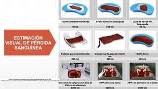 ESTIMACIÓN
VISUAL DE PÉRDIDA
SANGUÍNEA
 