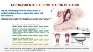 TAPONAMIENTO UTERINO: BALÓN DE BAKRI
Suarez S, Conde-Agudelo A, Borovac-Pinheiro A, et al. Uterine balloon tamponade for the treatment of postpartum hemorrhage: a systematic
review and meta-analysis. Am J Obstet Gynecol 2020;222:293.e1-52
Tasa global de éxito 85,9% (IC 95%, 83,9-87,9%)
Las tasas de éxito más elevadas correspondieron a atonía
uterina (87.1%) y placenta previa (86.8%)
Tasas de éxito más bajas en relación a placenta acreta (66.7%) y
restos (76.8%)
Cesárea (81.7%) parto vaginal (87%)
Tasa de complicaciones fue del 6,5%
 