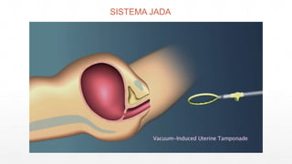 SISTEMA JADA
 