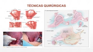 TÉCNICAS QUIRÚRGICAS
 