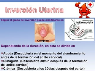 En la hemorragia posparto existen signos que son: 
Sangrado por vía vaginal de moderado a grave 
Hipotensión 
Taquicardia ...