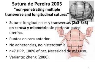 Sutura de Pereira 2005

“non-penetrating multiple
transverse and longitudinal sutures”
• Suturas longitudinales y transversas (2x3-3x3)
en serosa y miometrio sin perforar pared
uterina.
• Puntos en cara anterior.
• No adherencias, no histerotomía.
• n=7 HPP, 100% eficaz. Necesidad de más uso.
• Variante: Zheng (2006).
33

 