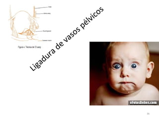 ig
L

d
ra
du
a

so
va
e

s
co
vi
l
pé
s

36

 