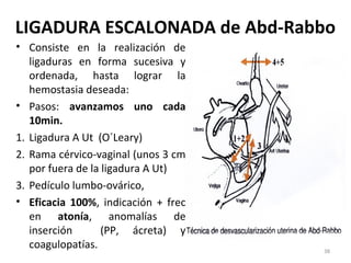 LIGADURA ESCALONADA de Abd-Rabbo
• Consiste en la realización de
ligaduras en forma sucesiva y
ordenada, hasta lograr la
hemostasia deseada:
• Pasos: avanzamos uno cada
10min.
1. Ligadura A Ut (O´Leary)
2. Rama cérvico-vaginal (unos 3 cm
por fuera de la ligadura A Ut)
3. Pedículo lumbo-ovárico,
• Eficacia 100%, indicación + frec
en atonía, anomalías de
inserción
(PP, ácreta) y
coagulopatías.

38

 