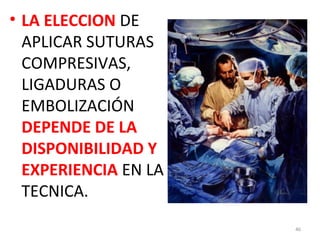 • LA ELECCION DE
APLICAR SUTURAS
COMPRESIVAS,
LIGADURAS O
EMBOLIZACIÓN
DEPENDE DE LA
DISPONIBILIDAD Y
EXPERIENCIA EN LA
TECNICA.
46

 