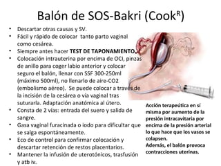 Balón de SOS-Bakri (Cook )
R

• Descartar otras causas y SV.
• Fácil y rápido de colocar tanto parto vaginal
como cesárea.
• Siempre antes hacer TEST DE TAPONAMIENTO.
• Colocación intrauterina por encima de OCI, pinzas
de anillo para coger labio anterior y colocar
seguro el balón, llenar con SSF 300-250ml
(máximo 500ml), no llenarlo de aire-CO2
(embolismo aéreo). Se puede colocar a través de
la incisión de la cesárea o vía vaginal tras
suturarla. Adaptación anatómica al útero.
• Consta de 2 vías: entrada del suero y salida de
sangre.
• Gasa vaginal furacinada o iodo para dificultar que
se salga espontáneamente.
• Eco de control para confirmar colocación y
descartar retención de restos placentarios.
• Mantener la infusión de uterotónicos, trasfusión
y atb iv.

Acción terapeútica en sí
misma por aumento de la
presión intracavitaria por
encima de la presión arterial
lo que hace que los vasos se
colapsen.
Además, el balón provoca
contracciones uterinas.

 