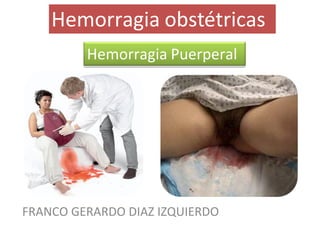 Hemorragia obstétricas
         Hemorragia Puerperal




FRANCO GERARDO DIAZ IZQUIERDO
 
