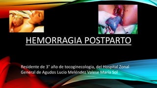 HEMORRAGIA POSTPARTO
Residente de 3° año de tocoginecologia, del Hospital Zonal
General de Agudos Lucio Meléndez Valese María Sol
 