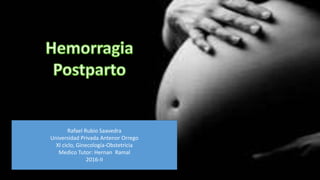 Rafael Rubio Saavedra
Universidad Privada Antenor Orrego
XI ciclo, Ginecología-Obstetricia
Medico Tutor: Hernan Ramal
2016-II
 