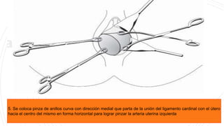 HEMORRAGIA POSTPARTO .pptx