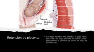 Retención de placenta
 