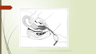 WHO GUIDELINES FOR THE MANAGEMENT OF POSTPARTUM HAEMORRAGHE 2009
 