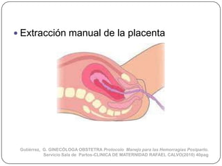  Extracción manual de la placenta




 Gutiérrez, G. GINECÓLOGA OBSTETRA Protocolo Manejo para las Hemorragias Postparto....