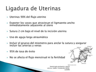

Uterinas 90% del flujo uterino



Exponer los vasos que atraviesan el ligmaento ancho
inmediatamente adyacente al úter...