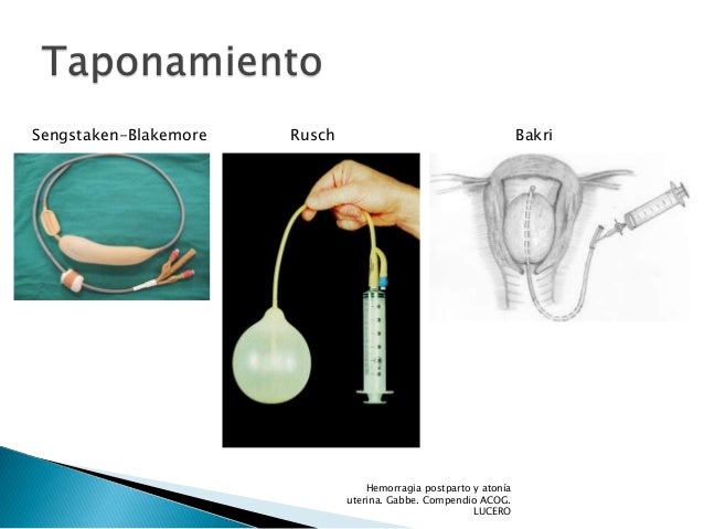 Resultado de imagen para TAPONAMIENTO CON BALÃN UTERINO DE BAJO COSTE