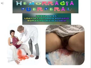 HEMORRAGIA PUERPERAL
 