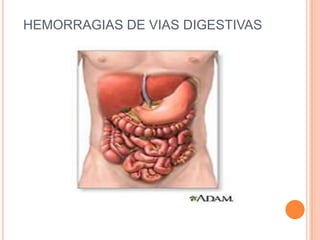 HEMORRAGIAS DE VIAS DIGESTIVAS  