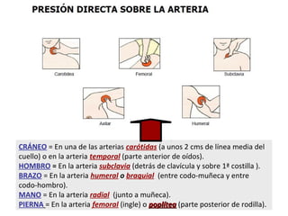 CRÁNEO = En una de las arterias carótidas (a unos 2 cms de línea media del
cuello) o en la arteria temporal (parte anterior de oídos).
HOMBRO = En la arteria subclavia (detrás de clavícula y sobre 1ª costilla ).
BRAZO = En la arteria humeral o braquial (entre codo-muñeca y entre
codo-hombro).
MANO = En la arteria radial (junto a muñeca).
PIERNA = En la arteria femoral (ingle) o poplítea (parte posterior de rodilla).
 