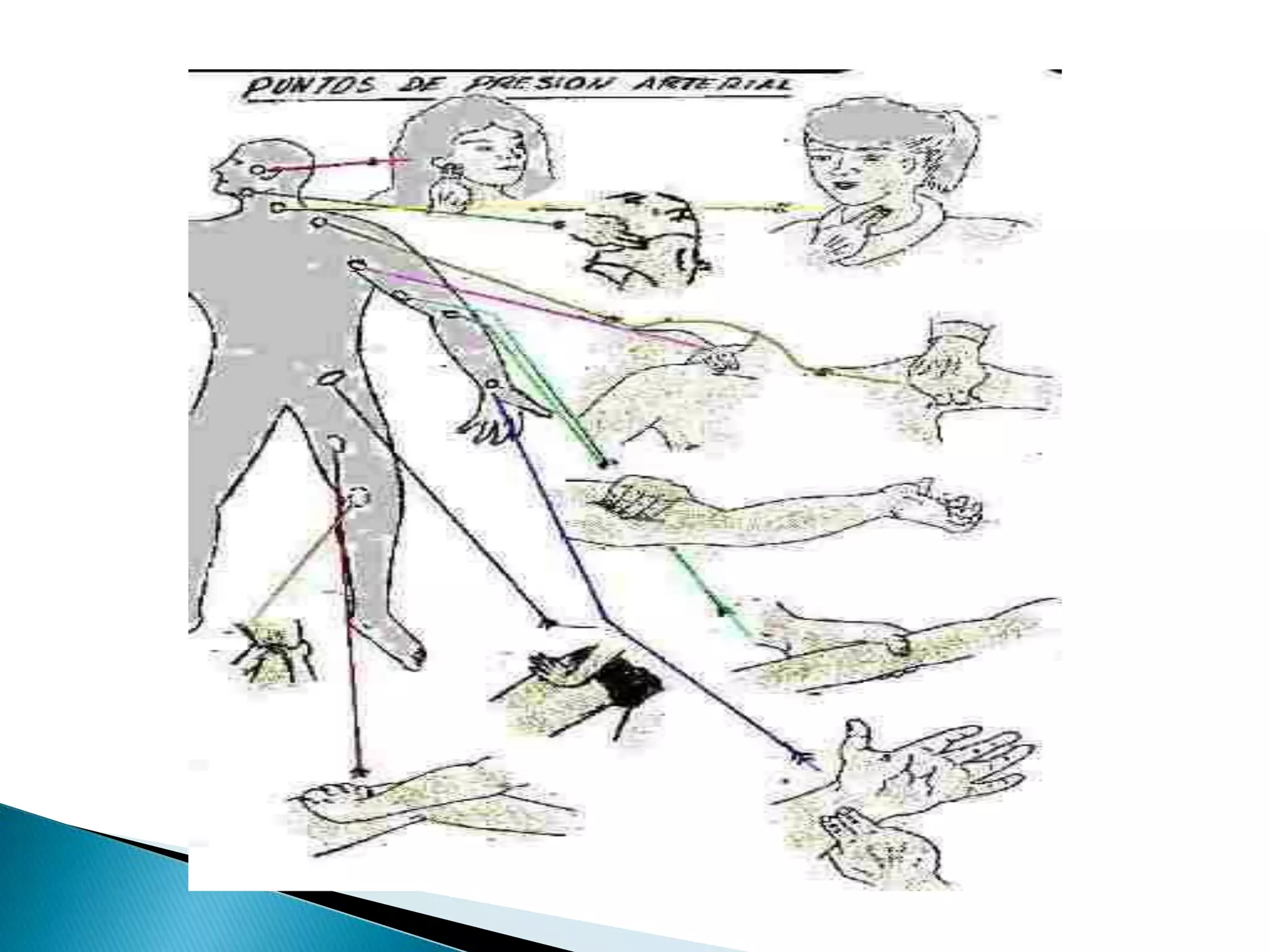 Hemorragias 130423005626-phpapp01 | PDF