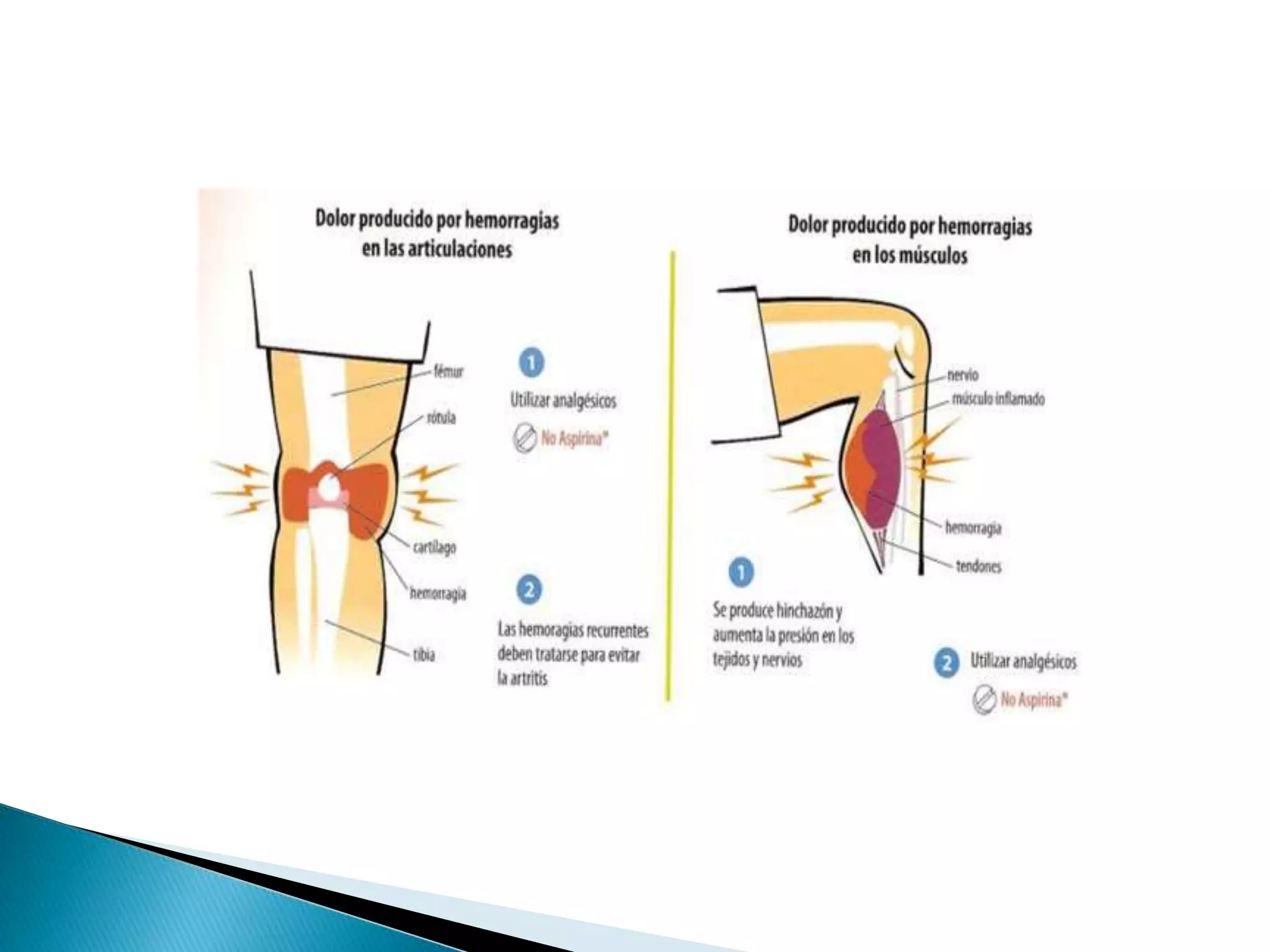 Hemorragias 130423005626-phpapp01 | PDF