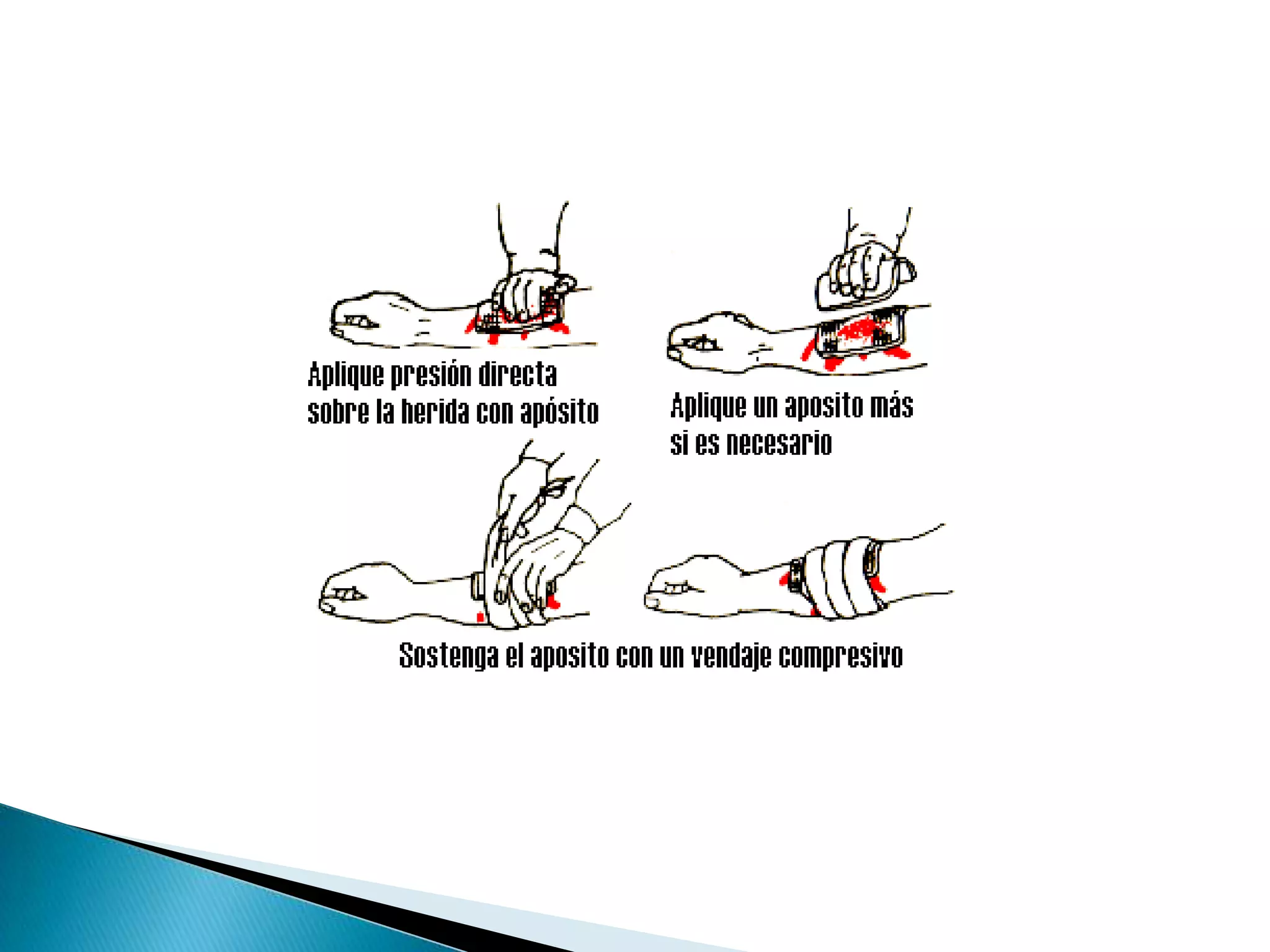 Hemorragias 130423005626-phpapp01 | PDF