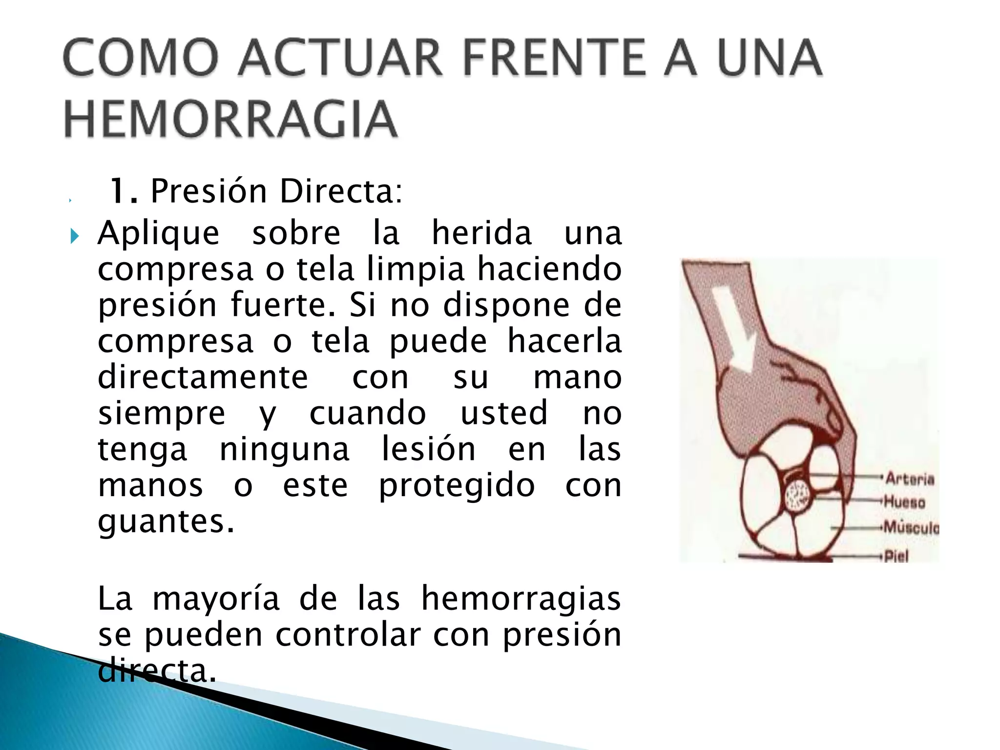  1. Presión Directa:
 Aplique sobre la herida una
compresa o tela limpia haciendo
presión fuerte. Si no dispone de
compresa o tela puede hacerla
directamente con su mano
siempre y cuando usted no
tenga ninguna lesión en las
manos o este protegido con
guantes.
La mayoría de las hemorragias
se pueden controlar con presión
directa.
 