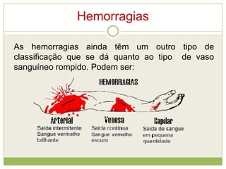 Hemorragias
As hemorragias ainda têm um outro tipo de
classificação que se dá quanto ao tipo de vaso
sanguíneo rompido. Podem ser:
 