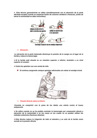 Esta técnica generalmente se utiliza simultáneamente con la elevación de la parte
afectada excepto cuando se sospeche lesión de columna vertebral o fracturas, (antes de
elevar la extremidad se debe inmovilizar).
2. Elevación:
La elevación de la parte lesionada disminuye la presión de la sangre en el lugar de la
herida y reduce la hemorragia.
Si la herida está situada en un miembro superior o inferior, levántelo a un nivel
superior al corazón.
Cubra los apósitos con una venda de rollo.
Si continua sangrando coloque apósitos adicionales sin retirar el vendaje inicial.
3. Presión Directa sobre la Arteria:
Consiste en comprimir con la yema de los dedos una arteria contra el hueso
subyacente.
Se utiliza cuando no se ha podido controlar la hemorragia por compresión directa y
elevación de la extremidad o en los casos en los cuales no se pueden utilizar los
métodos anteriores (fracturas abiertas).
Esta técnica reduce la irrigación de todo el miembro y no solo de la herida como
sucede en la presión directa.
 