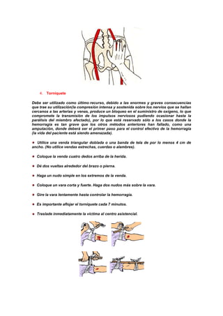 4. Torniquete
Debe ser utilizado como último recurso, debido a las enormes y graves consecuencias
que trae su utilización(la compresión intensa y sostenida sobre los nervios que se hallan
cercanos a las arterias y venas, produce un bloqueo en el suministro de oxígeno, lo que
compromete la transmisión de los impulsos nerviosos pudiendo ocasionar hasta la
parálisis del miembro afectado), por lo que está reservado sólo a los casos donde la
hemorragia es tan grave que los otros métodos anteriores han fallado, como una
amputación, donde deberá ser el primer paso para el control efectivo de la hemorragia
(la vida del paciente está siendo amenazada).
Utilice una venda triangular doblada o una banda de tela de por lo menos 4 cm de
ancho. (No utilice vendas estrechas, cuerdas o alambres).
Coloque la venda cuatro dedos arriba de la herida.
Dé dos vueltas alrededor del brazo o pierna.
Haga un nudo simple en los extremos de la venda.
Coloque un vara corta y fuerte. Haga dos nudos más sobre la vara.
Gire la vara lentamente hasta controlar la hemorragia.
Es importante aflojar el torniquete cada 7 minutos.
Traslade inmediatamente la víctima al centro asistencial.
 