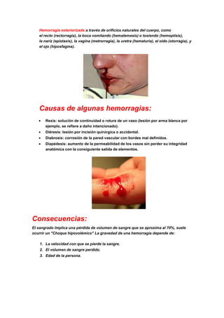 Hemorragia exteriorizada:a través de orificios naturales del cuerpo, como
el recto (rectorragia), la boca vomitando (hematemesis) o tosiendo (hemoptisis),
la nariz (epistaxis), la vagina (metrorragia), la uretra (hematuria), el oído (otorragia), y
el ojo (hiposfagma).
Causas de algunas hemorragias:
Rexis: solución de continuidad o rotura de un vaso (lesión por arma blanca por
ejemplo, se refiere a daño intencionado).
Diéresis: lesión por incisión quirúrgica o accidental.
Diabrosis: corrosión de la pared vascular con bordes mal definidos.
Diapédesis: aumento de la permeabilidad de los vasos sin perder su integridad
anatómica con la consiguiente salida de elementos.
Consecuencias:
El sangrado implica una pérdida de volumen de sangre que se aproxima al 70%, suele
ocurrir un "Choque hipovolémico" La gravedad de una hemorragia depende de:
1. La velocidad con que se pierde la sangre.
2. El volumen de sangre perdido.
3. Edad de la persona.
 