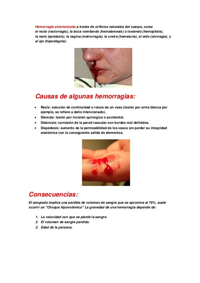 Hemorragias