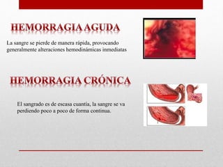 La sangre se pierde de manera rápida, provocando
generalmente alteraciones hemodinámicas inmediatas
El sangrado es de escasa cuantía, la sangre se va
perdiendo poco a poco de forma continua.
 