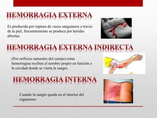 Es producida por ruptura de vasos sanguíneos a través
de la piel, frecuentemente se produce por heridas
abiertas
(Por orificios naturales del cuerpo) estas
hemorragias reciben el nombre propio en función a
la cavidad donde se vierta la sangre.
Cuando la sangre queda en el interior del
organismo
 